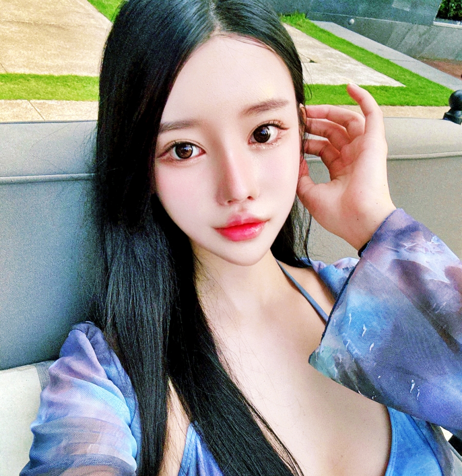 얼굴지방흡입 이미지 (4)