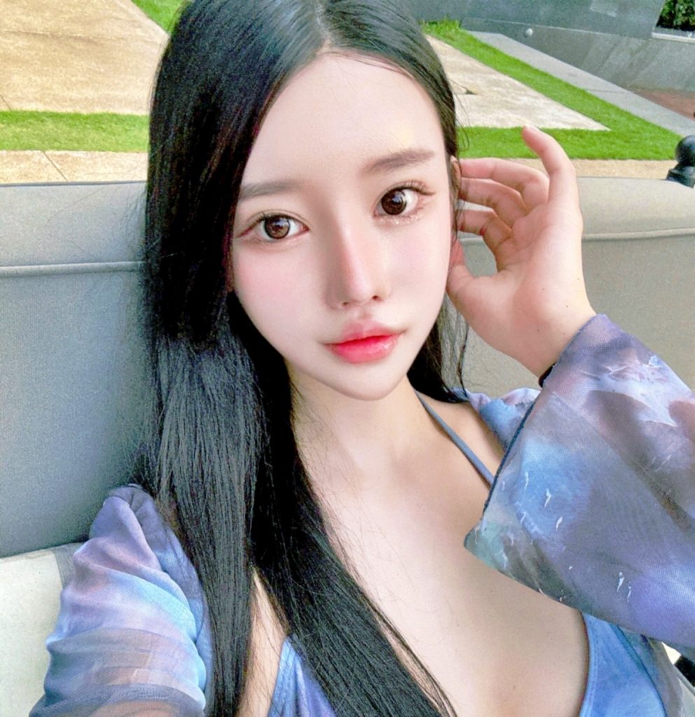 파워V 얼굴지방흡입 이미지 (4)