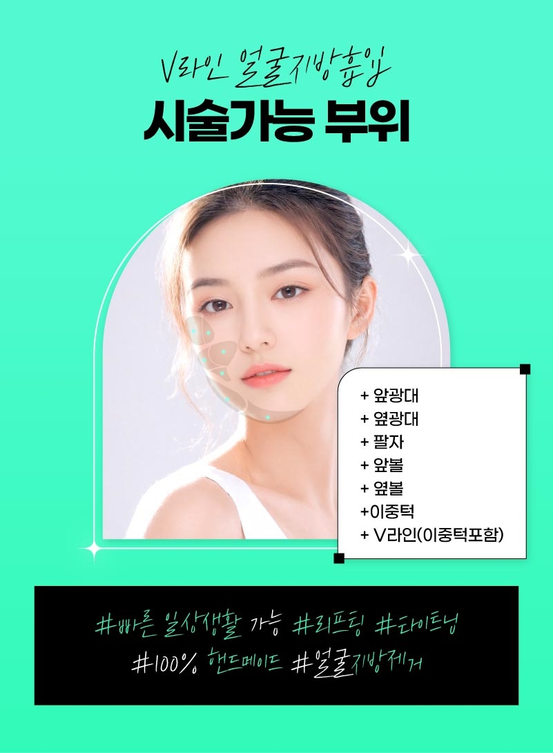 얼굴지방흡입 게시판 이미지 (14)