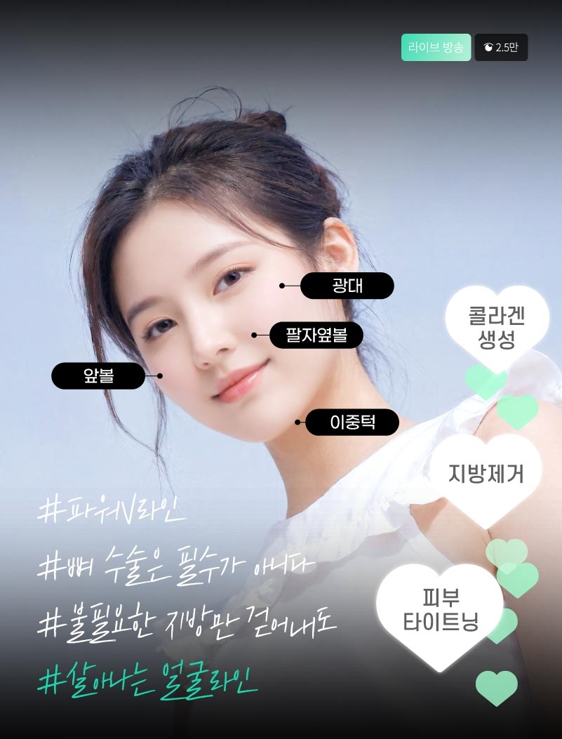 얼굴지방흡입 게시판 이미지 (5)